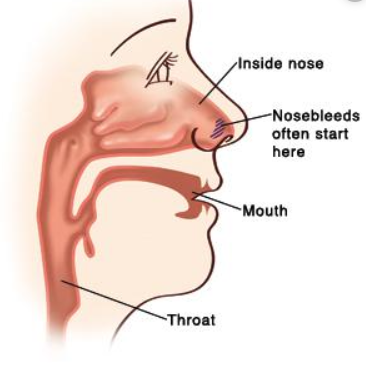 causes of a nosebleed