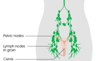 shotty lymph nodes of groin