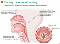 uti how long antibiotics